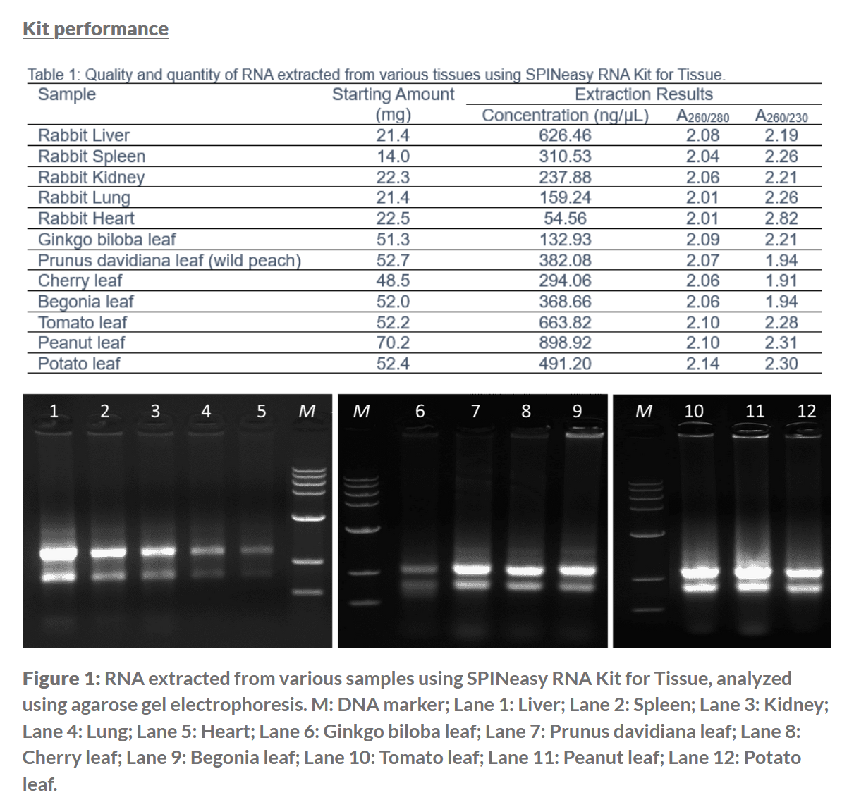 SPINeasy® RNA Kit for Tissue (Without Lysing Matrix) 50preps MP SPINeasy® RNA Kit for Tissue (Without Lysing Matrix) 50preps MP