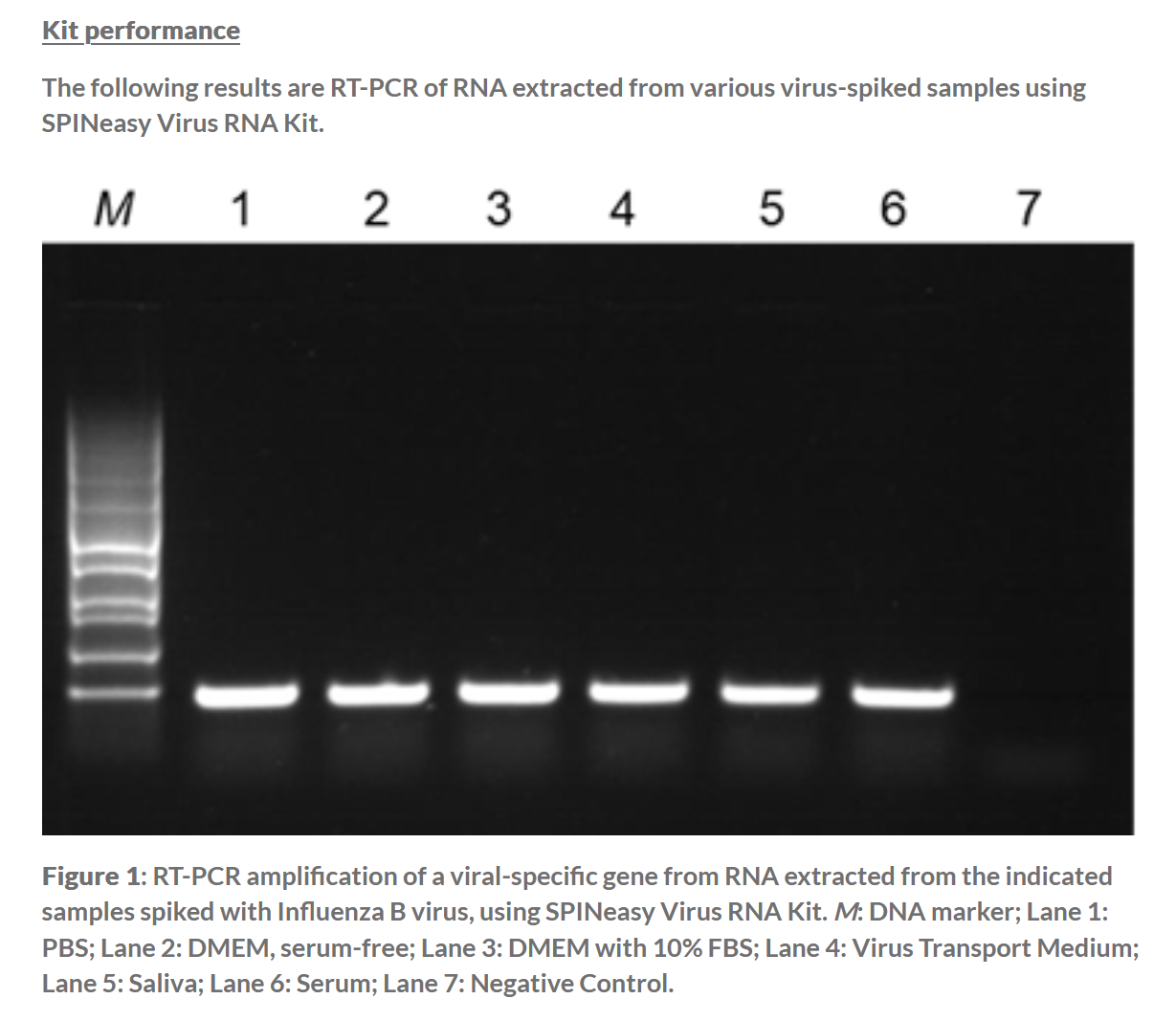 SPINeasy® Virus RNA Kit 50preps MP SPINeasy® Virus RNA Kit 50preps MP