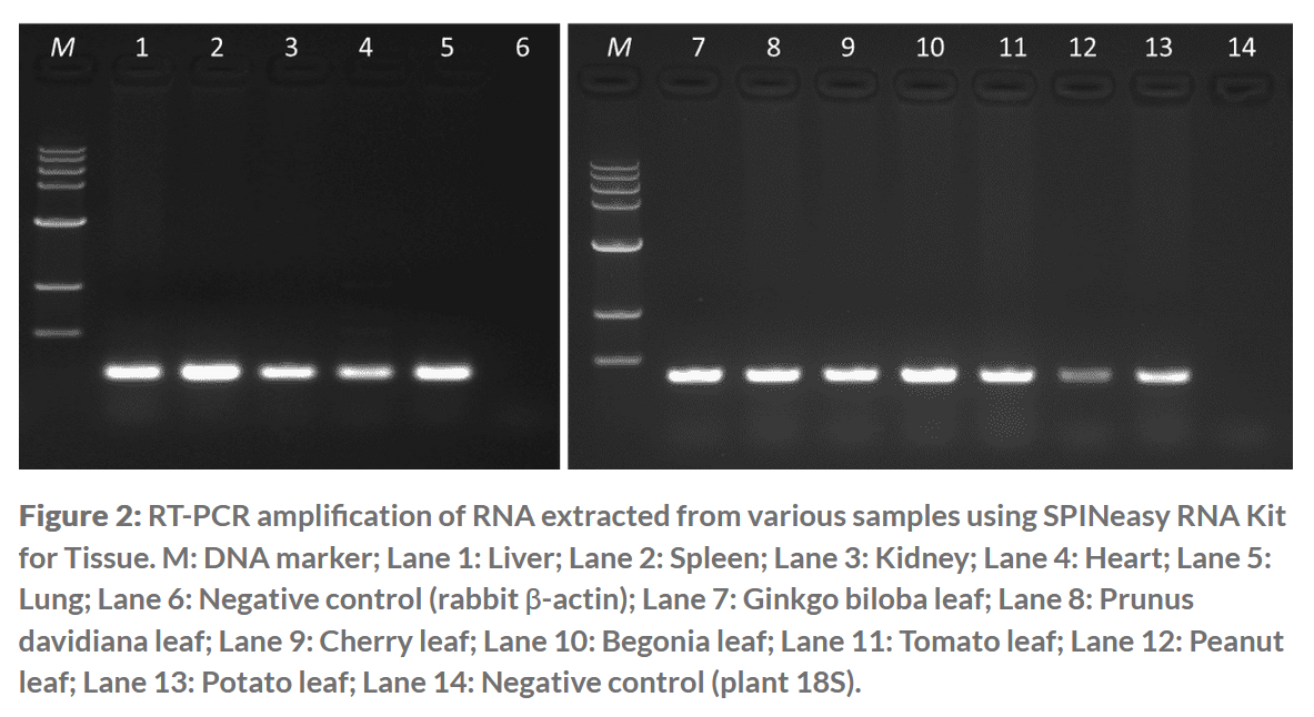 SPINeasy® RNA Kit for Tissue (Without Lysing Matrix) 50preps MP SPINeasy® RNA Kit for Tissue (Without Lysing Matrix) 50preps MP