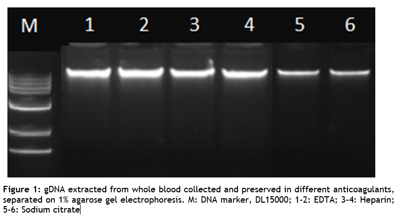 SPINeasy® DNA Kit for Blood 50preps MPBio SPINeasy® DNA Kit for Blood 50preps MPBio