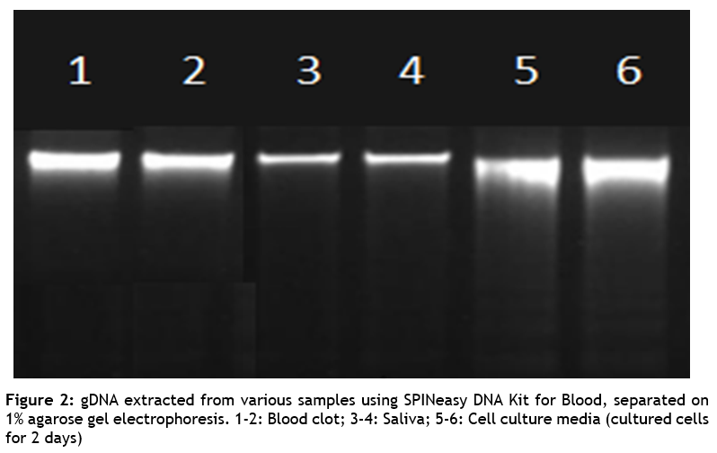 SPINeasy® DNA Kit for Blood 50preps MPBio SPINeasy® DNA Kit for Blood 50preps MPBio