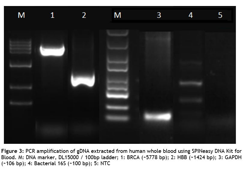 SPINeasy® DNA Kit for Blood 50preps MPBio SPINeasy® DNA Kit for Blood 50preps MPBio